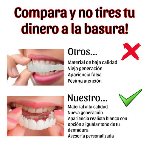Carillas Snap On Smile Veneers Dientes Temporales Estéticas
