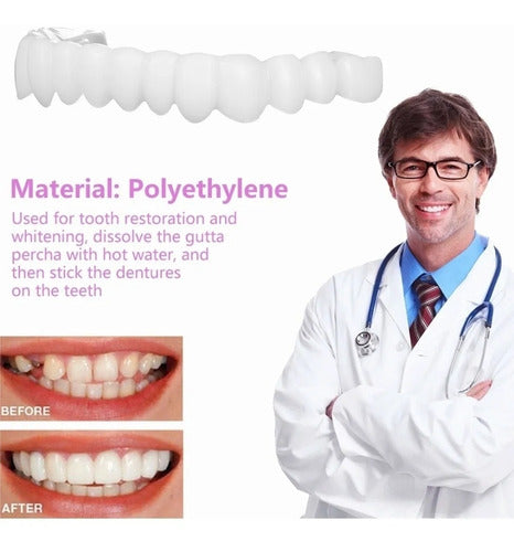 Carillas Estéticas Snap On Smile Veneers Dientes Temporales