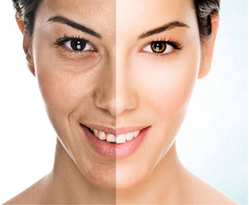 Jabón Arroz Tailandés Aclara Piel Exfolia Quita Manchas Acné