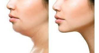 Kit Reduce Papada Define Mandibula Guasha + Gel + Mentonera