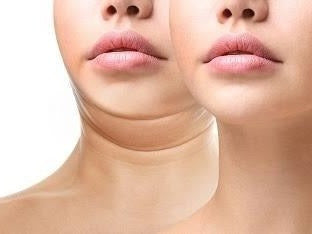 Kit Reduce Papada Define Mandibula Guasha + Gel + Mentonera