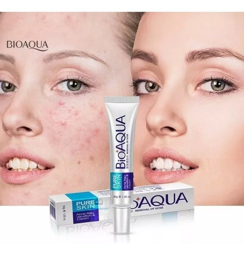 Bioaqua Pure Skin Crema Anti Acne Remueve Manchas Cicatrices