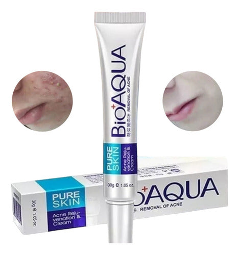 Bioaqua Pure Skin Crema Anti Acne Remueve Manchas Cicatrices