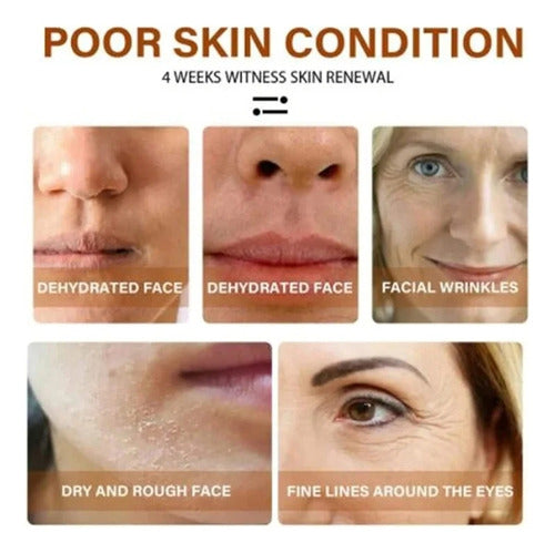 Mascarilla 100% Hidrosoluble Colágeno Y Ácido Hialuronico