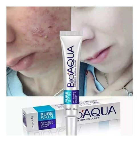 Bioaqua Pure Skin Crema Anti Acne Remueve Manchas Cicatrices