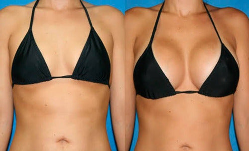 Kit De Belleza Aumento Busto Y Glúteos Joy Natura Naturani